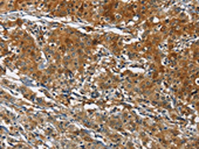CAST Antibody
