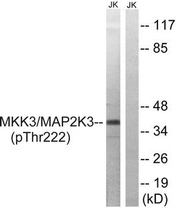 Phospho-MAP2K3 (Thr222) Antibody