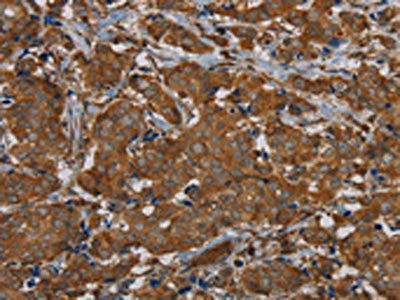 PIK3CD Antibody
