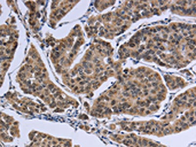 IPO8 Antibody