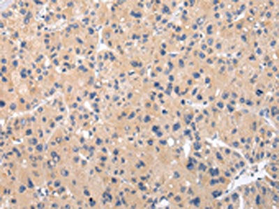 CHRM5 Antibody