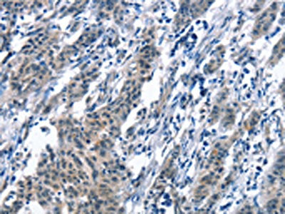 BNIP3L Antibody