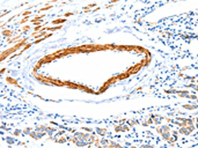 IMMT Antibody