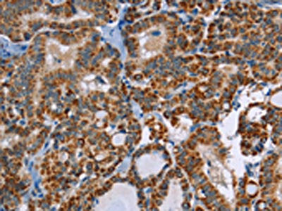 ABCB1 Antibody