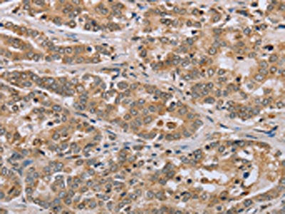 CLEC16A Antibody