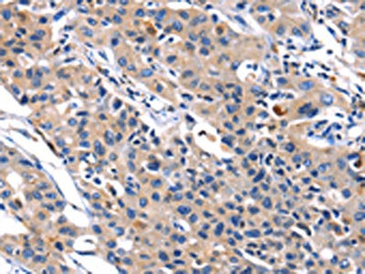 MMP16 Antibody