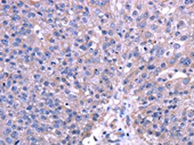 TRIM49 Antibody