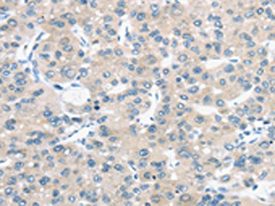TM9SF1 Antibody