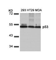 TP53 (Ab-9) Antibody