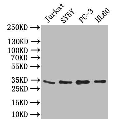 UCP1 Antibody