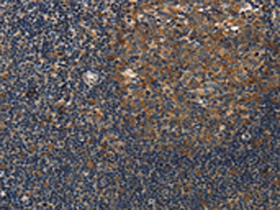 DSP Antibody