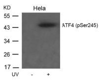 Phospho-ATF4 (Ser245) Antibody