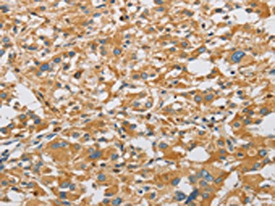 ARHGEF7 Antibody