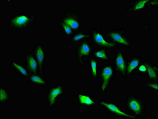 VAC14 Antibody