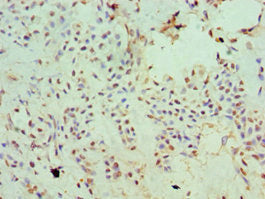 SLC20A2 Antibody