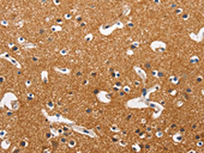 HK2 Antibody