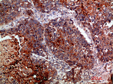 KMT2A Antibody