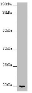 CETN1 Antibody