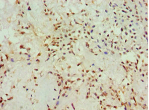 AKAP13 Antibody