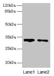 SLA Antibody