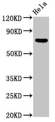 MTMR2 Antibody