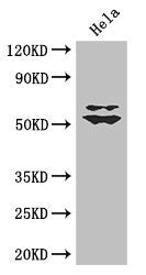 KLF5 Antibody