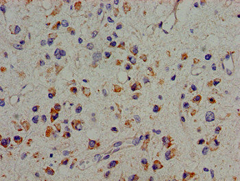 PTK2B Antibody