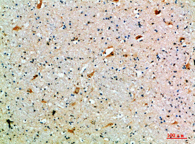 SEMA7A Antibody
