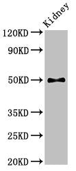 PDK1 Antibody