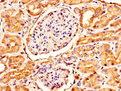GUCA2B Antibody