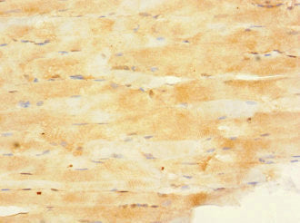 PPP1R3A Antibody