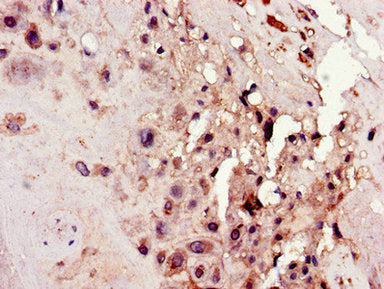 ODAPH Antibody