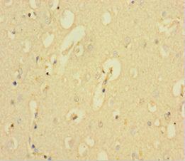 KCNMA1 Antibody