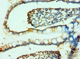 FAP Antibody