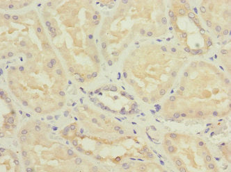 NME3 Antibody