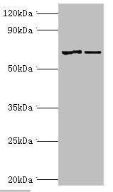 MTM1 Antibody