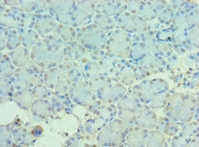 MTM1 Antibody