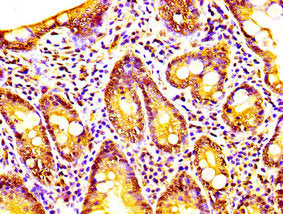 CAPRIN1 Antibody