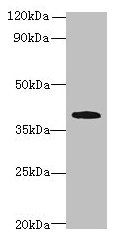 PRPSAP1 Antibody