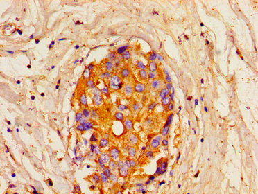 ITPR1 Antibody