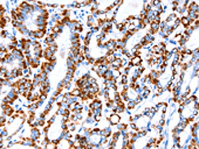 ACAA2 Antibody