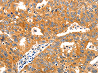 PAFAH1B1 Antibody