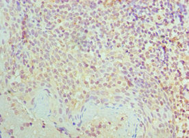 SMC1A Antibody