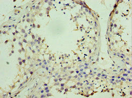 STK38 Antibody