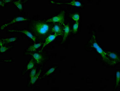 RAB35 Antibody