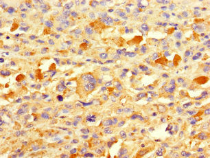 TAF13 Antibody