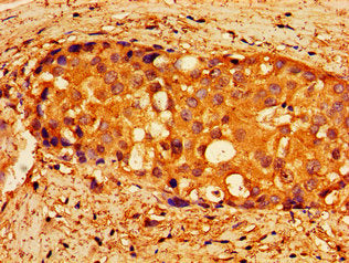 NPTX1 Antibody