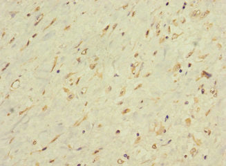 LONRF1 Antibody