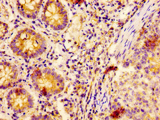 EPS8 Antibody