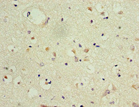 GRIN2B Antibody